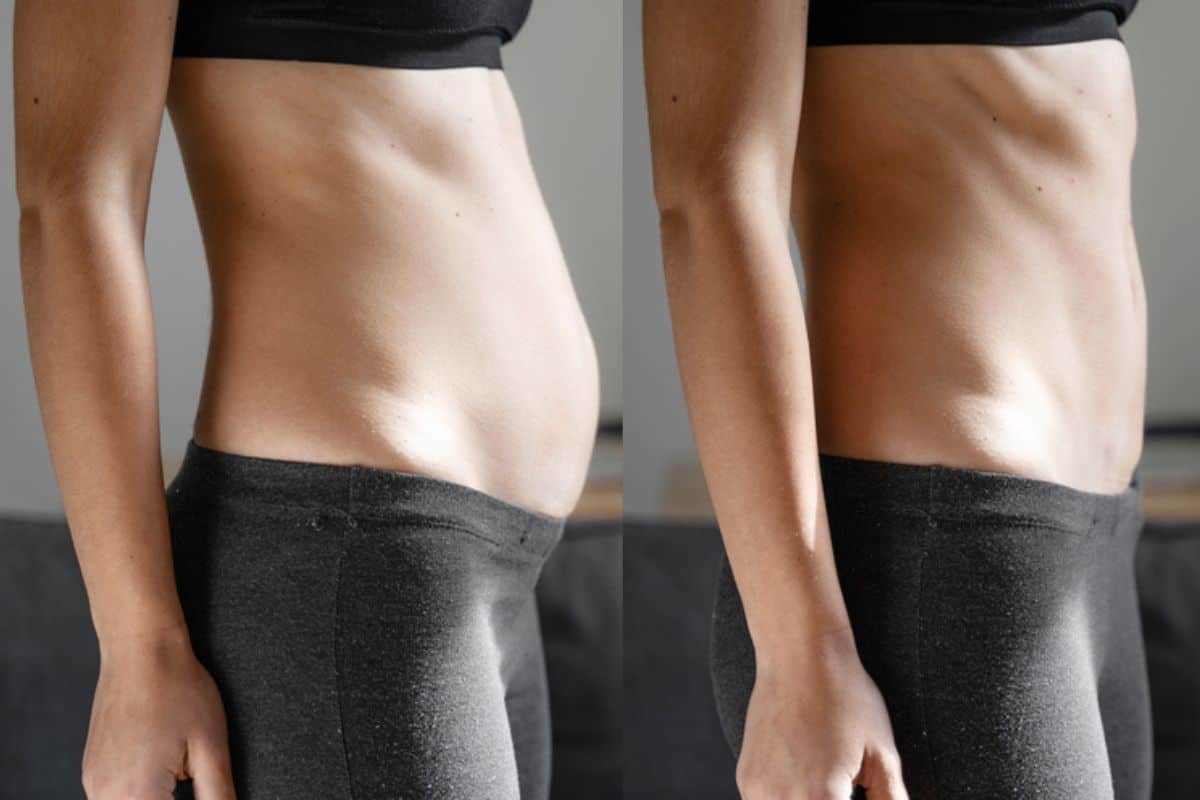 Post-Pregnancy: What Happens to Your Abdominal Muscles After Birth Sidcup