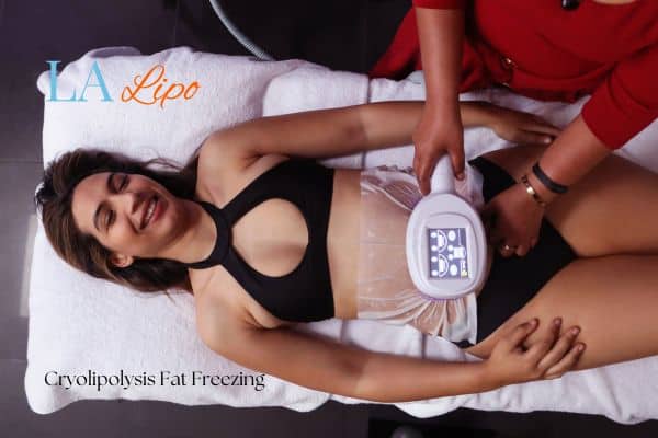 woman getting cryolipolysis Sidcup