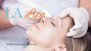 Woman receiving Actinic Keratosis Removal Treatment Sidcup