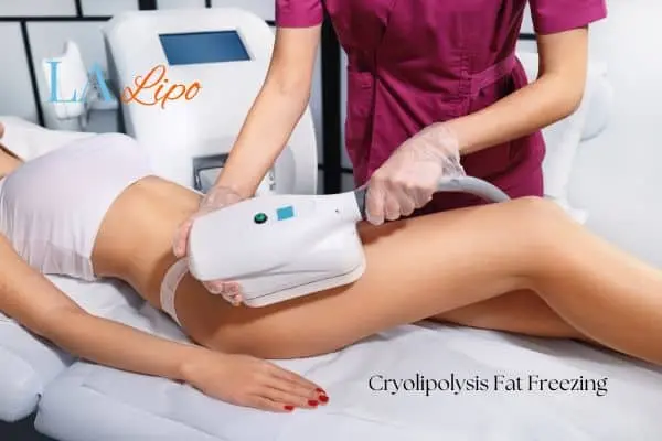 Woman receiving coolsculpting Sidcup treatment on her thighs
