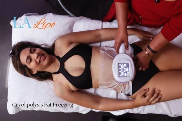 woman getting cryolipolysis Sidcup