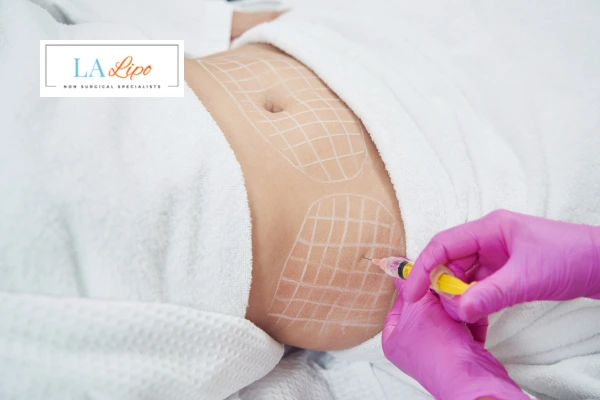 aqualyx fat dissolving injections Sidcup