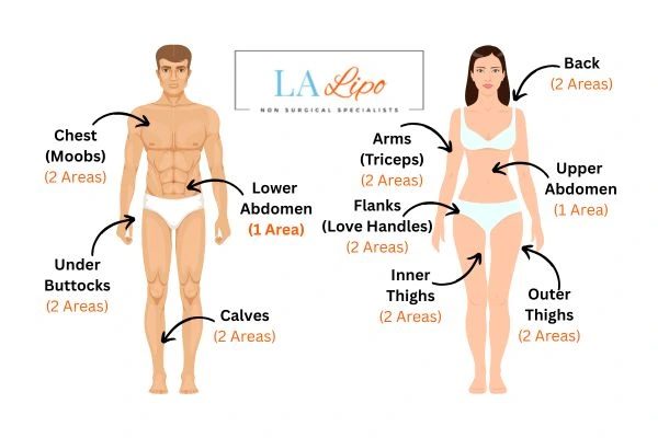 LA LIPO Cryolipolysis Areas Sidcup