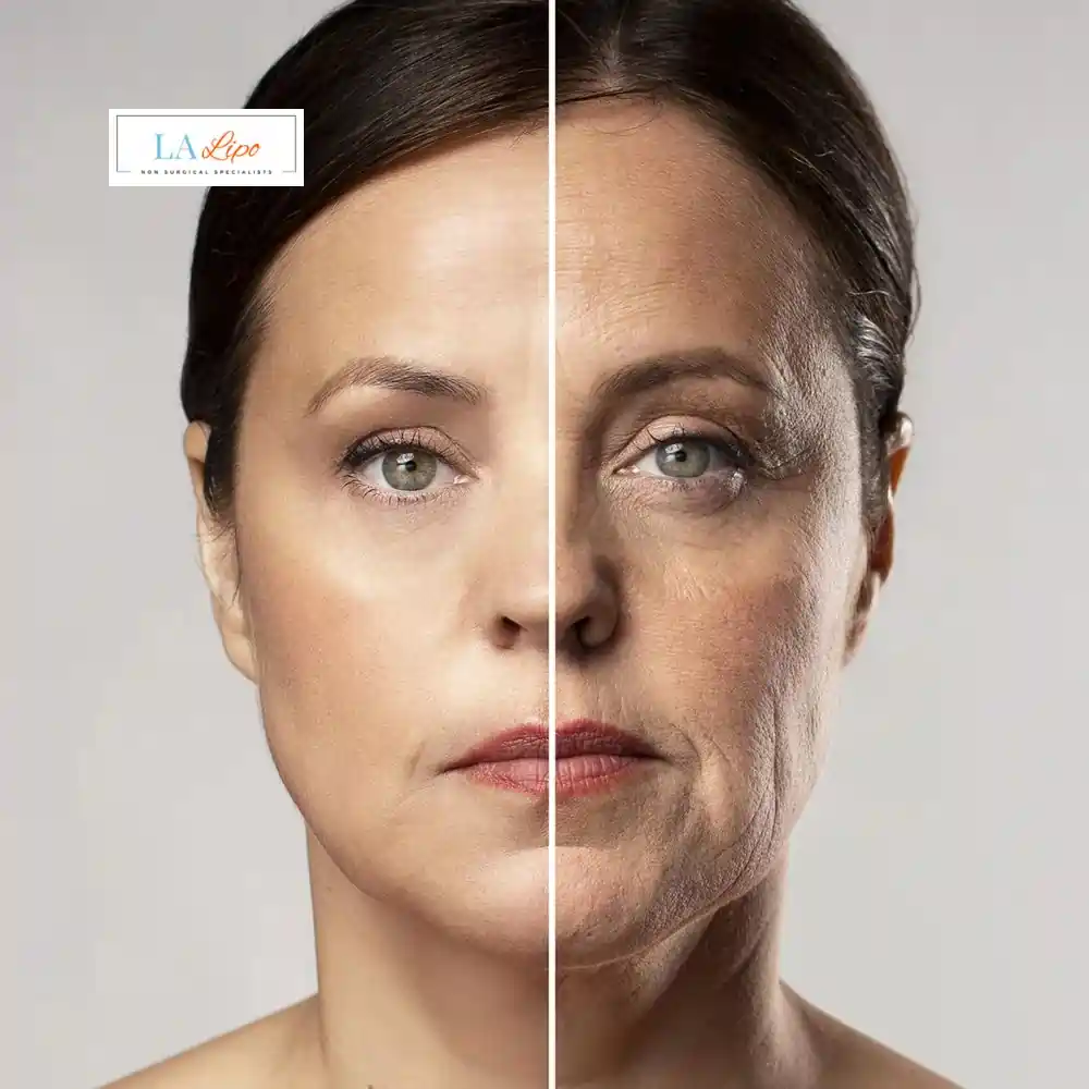 How Can You Tell If Non-Surgical Skin Tightening Is Right for You Sidcup?