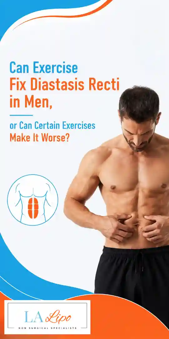 Can Exercise Fix Diastasis Recti in Men, or Can Certain Exercises Make It Worse Sidcup?