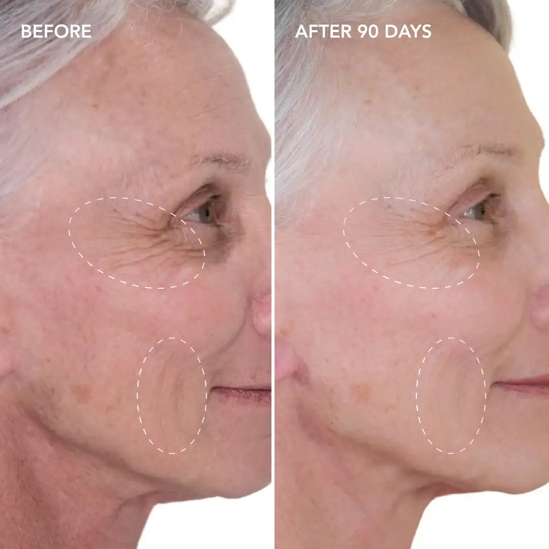 When will you see results Sidcup